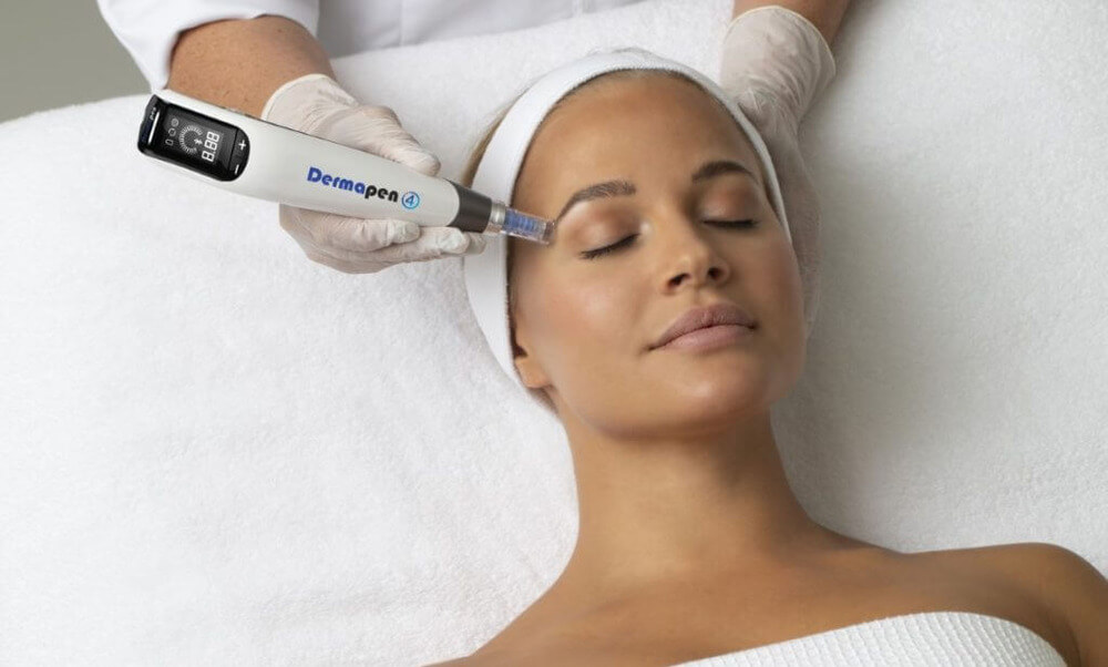 Dermapen-4-medicinski-microneedling